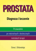 9788365717313 Prostata Diagnoza i leczenie Sklianskaja Elena J. Aba