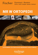 978-83-64737-71-8 Atlas diagnostyki MR w ortopedii W. Fischer Autor W. Fischer, A. Guermazi, F. Roemer, J. Carrino, M. Crema, A. Grainger, R. Kijowski, L. Steinbach Medipage