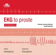 EKG - zdjęcie 1