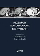 9788320059298 Przerzuty nowotworowe do wątroby PZWL