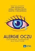 9788301233242 Alergie oczu. Ilustrowane kompendium dla praktyków Bogacka Ewa, Groblewska Anna, Chełmińska Marta PZWL