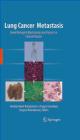 9781441907714 Lung Cancer Metastasis V Keshamouni Springer Verlag