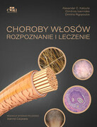 9788367447744 Choroby włosów. Rozpoznanie i leczenie Katoulis Alexander C. , Rigopoulos Dimitris Edra Urban & Partner