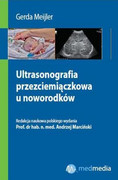 9788362875108 Ultrasonografia przezciemiączkowa u noworodków Medipage
