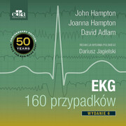EKG