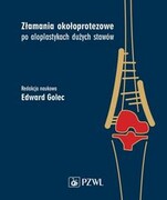 9788320063332 Złamania okołoprotezowe po aloplastykach dużych stawów Golec Edward PZWL