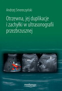 9788366632141 Otrzewna, jej duplikacje i zachyłki w ultrasonografii przezbrzusznej Andrzej Smereczyński Medipage