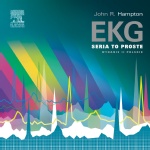 EKG - zdjęcie 2