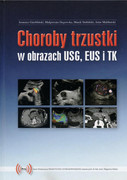 978-83-933378-0-4 Choroby trzustki w obrazach USG, EUS i TK Inny