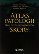 9788320047257 Atlas patologii złośliwych nowotworów skóry Woźniak Leszek, Zieliński Krzysztof W., Kaszuba Andrzej PZWL