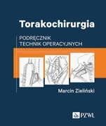 9788301231170 Torakochirurgia Zieliński Marcin PZWL