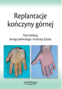 9788365946263 Replantacje kończyny górnej red. Jerzy Jabłecki, Andrzej Żyluk Medipage
