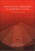 83-922237-0-5 Diagnostyka obrazowa w chorobach sutka Wiesław Jakubowski Roztoczańska Szkoła Ultrasonografii