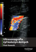 978-83-61104-74-2 Ultrasonografia żył kończyn dolnych Kawecki Piotr Kawecki Medipage